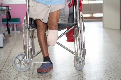 Image of an amputated leg