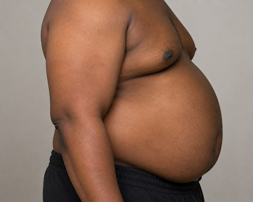 Man with pot belly