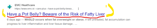 PubMed Central — Excess Fat liver research citation